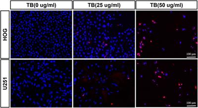 Theabrownin Induces Cell Apoptosis and Cell Cycle Arrest of Oligodendroglioma and Astrocytoma in Different Pathways